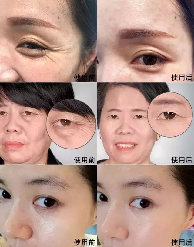 不起眼的乳膏有哪些,药店有一种不起眼的乳膏