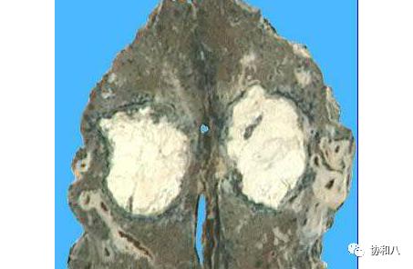 复习这些名解时总觉得怪饿的|协和八·脑洞大开