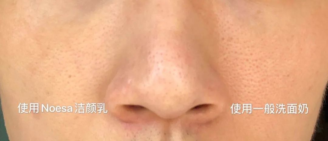 隔离14天后红码变黄码了,隔离14天变美挑战