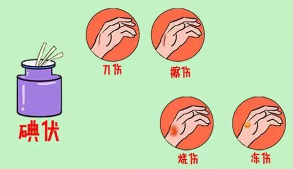 紫药水、红药水、酒精、碘伏…哪种处理伤口好？你可能一直都用错了