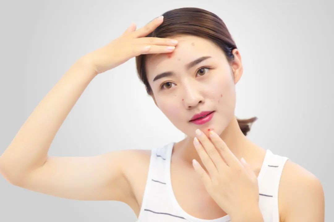 疮上有小泡很痒,疮长脓了抹什么药