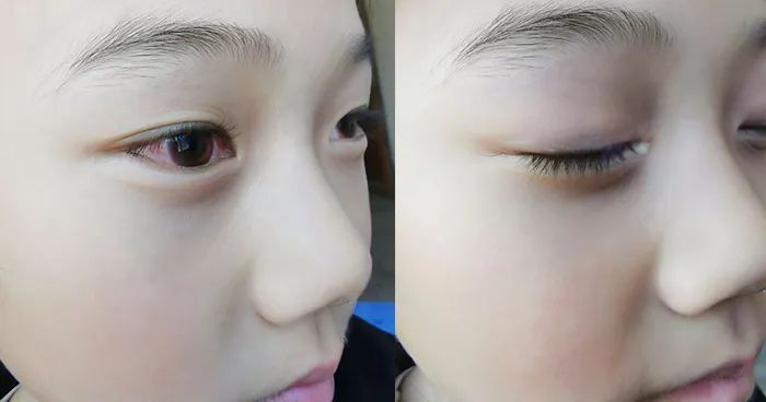 日本眼疲劳干涩护眼液,日本眼睛护眼神器