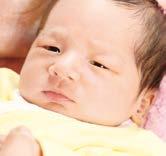 满月宝宝黄疸高,宝宝21天黄疸