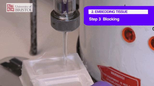 探秘病理科,病理科活检为什么慢