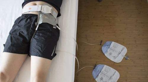 老人结肠癌晚期做了造口,76岁老人造口手术