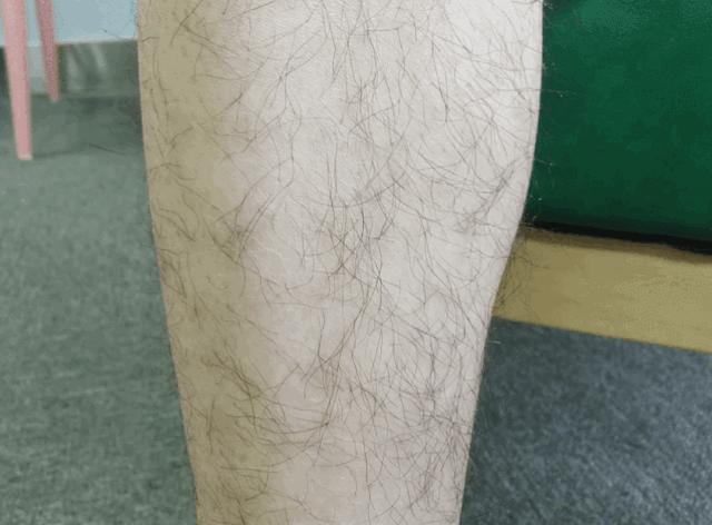 光滑无暇|黑丑的“毛裤腿”，用它，10分钟“脱”得一干二净，肌肤光滑细腻