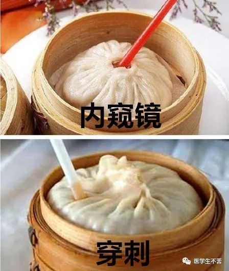 盘点医院各大科室侵入性检查：穿刺、内镜各显神通，小活检标本以“小”见“大”