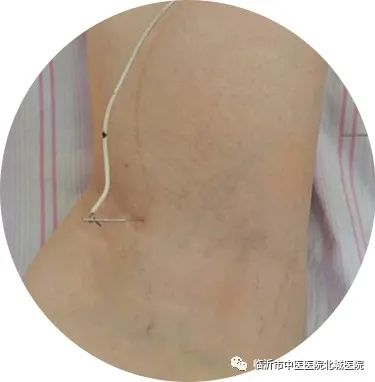 不用住院，医保报销！临沂这家医院的“中医日间病房”太赞了