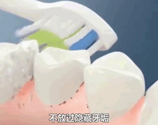 用这款神奇的专利牙膏刷一刷，3分钟KO细菌，老牙垢瞬间溶解，老黄牙不见了，多年的口臭都消失了，牙医强烈安利