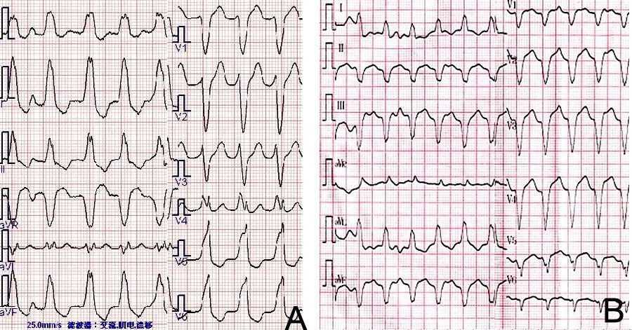 “绿宝书”丨精美图谱，生动形象！换个方式看心脏解剖（2）