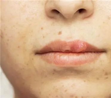 喝胶原蛋白要坚持多久才能有效果,紧急提醒经常喝这个的人要注意了