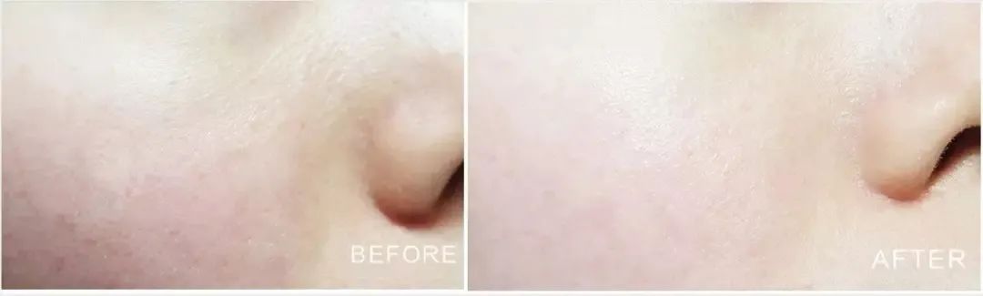 喝胶原蛋白要坚持多久才能有效果,紧急提醒经常喝这个的人要注意了