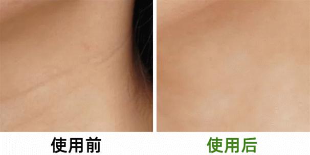 长期补充胶原蛋白的人怎么样了,长期喝胶原蛋白的人最后怎么样了