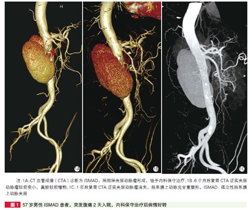 肠系膜上动脉夹层最佳治疗方法,孤立性肠系膜上动脉夹层