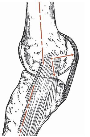 膝关节置换单膝和全膝,全膝关节置换能跪吗