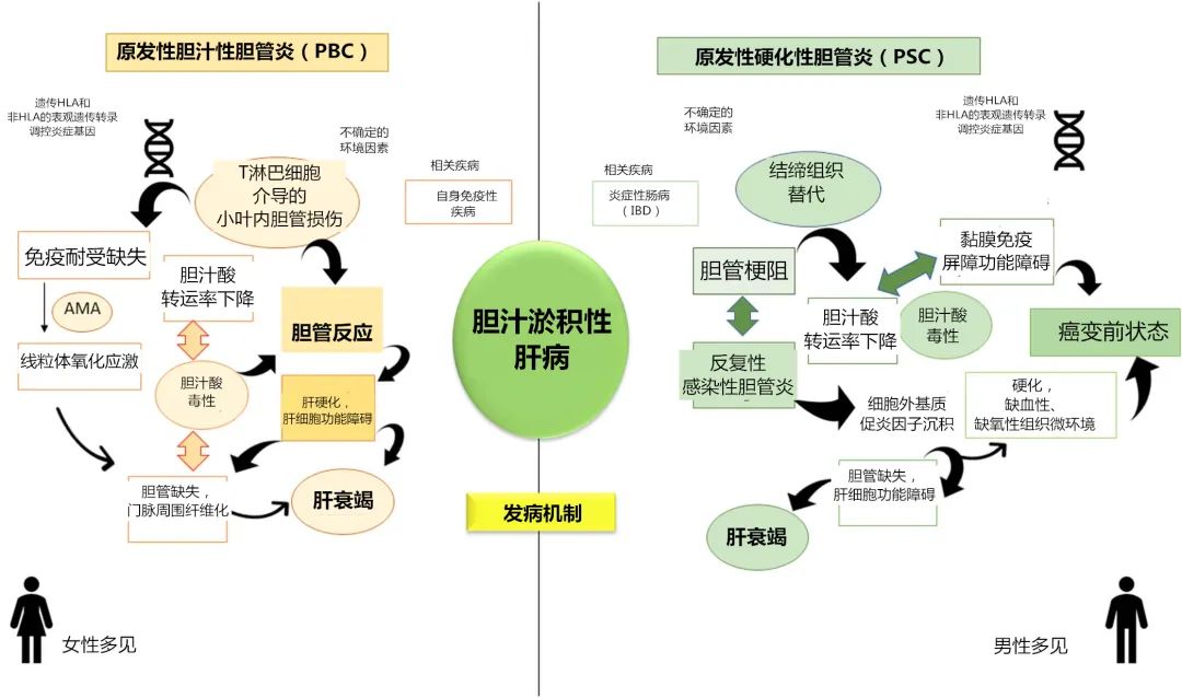 原发性硬化性胆管炎b超检查表现,原发性硬化性胆管炎最新研究
