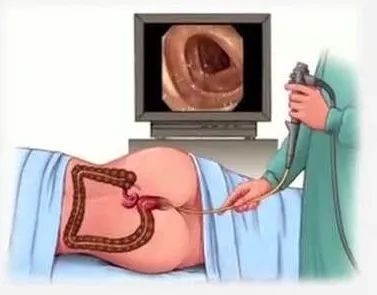 经直肠超声和经会阴超声的区别,腹部超声检查图像