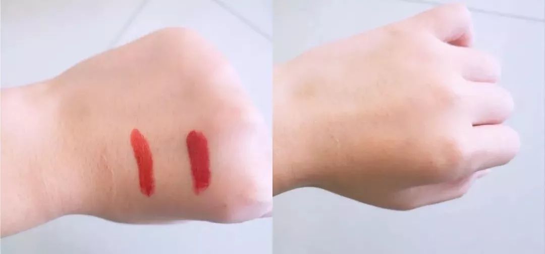 鼻头痘痘挤出来的白色物质是什么,团状红痘痘