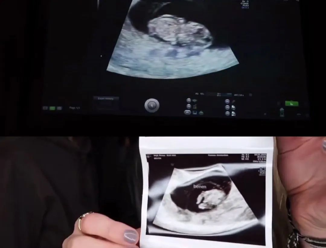 维密天使当今现状：表面上光鲜靓丽，背地里不来月经