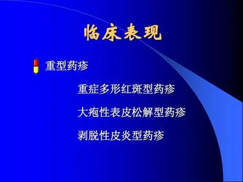 重症药疹怎么办,重症药疹患者预防感染如何护理