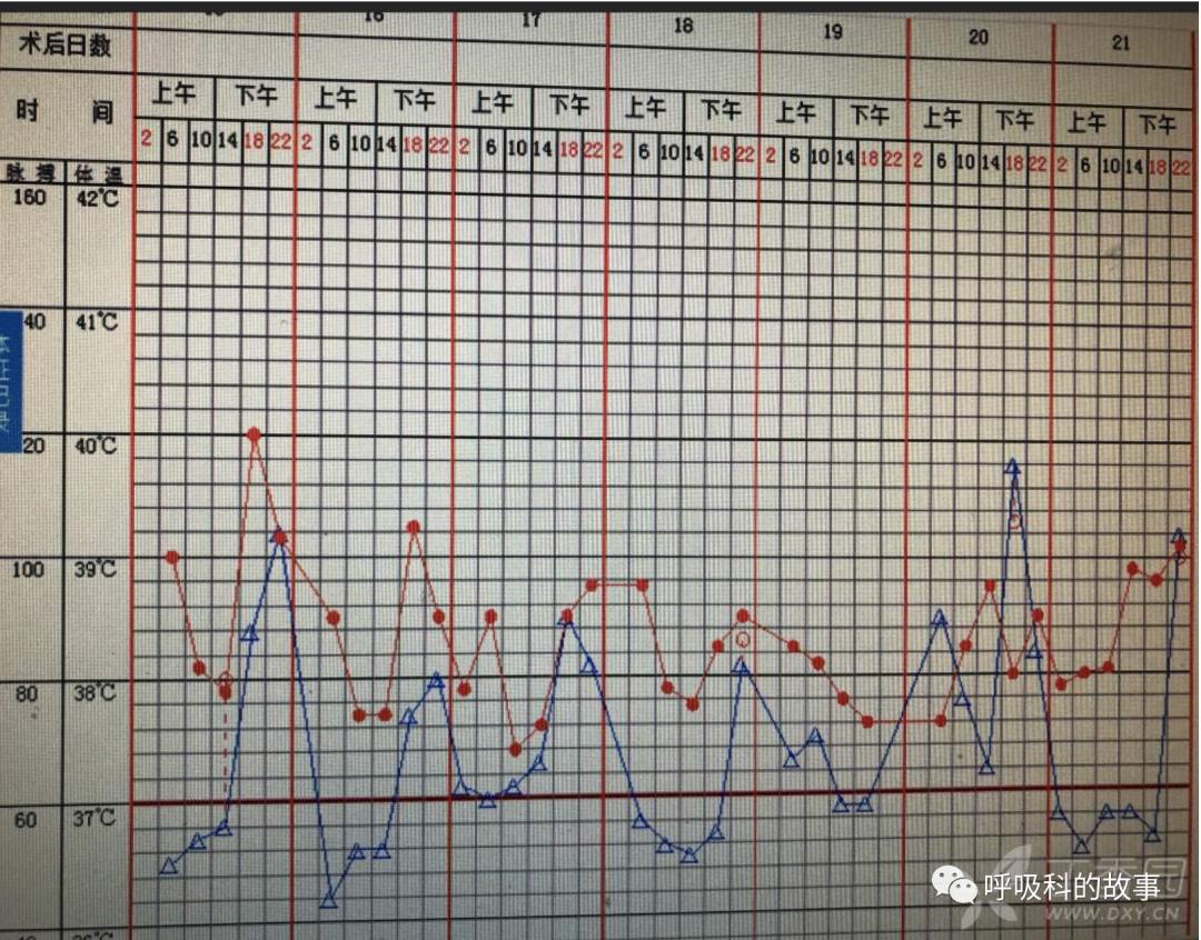五花八门的发热之一—药物热(1)