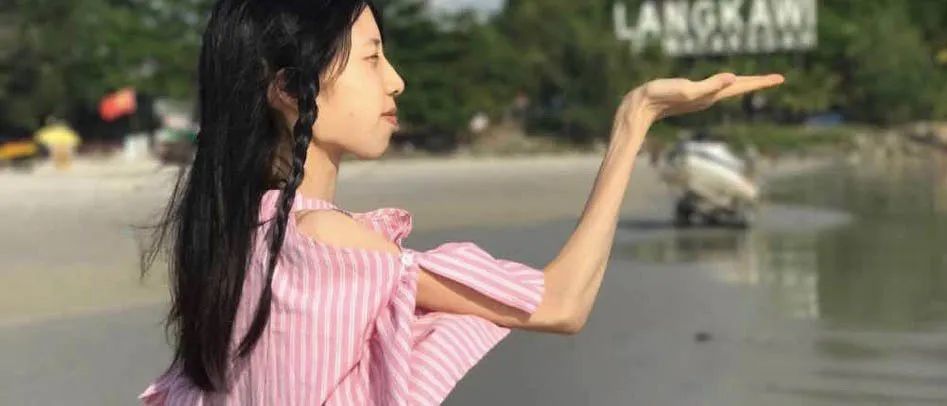 减肥21天icu,减肥到50斤进icu