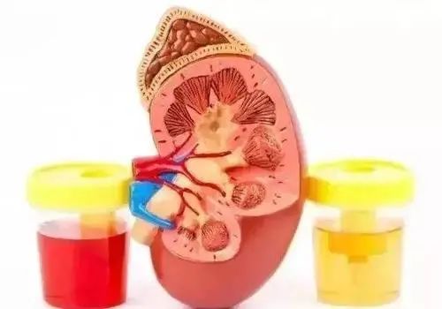 猫叫综合症是alport吗,alport综合征遗传几率