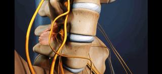 腰痛的真正原因是什么,腰痛要警惕五种原因