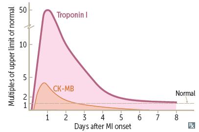 非st段抬高型心梗的治疗,非st抬高型心梗诊断标准