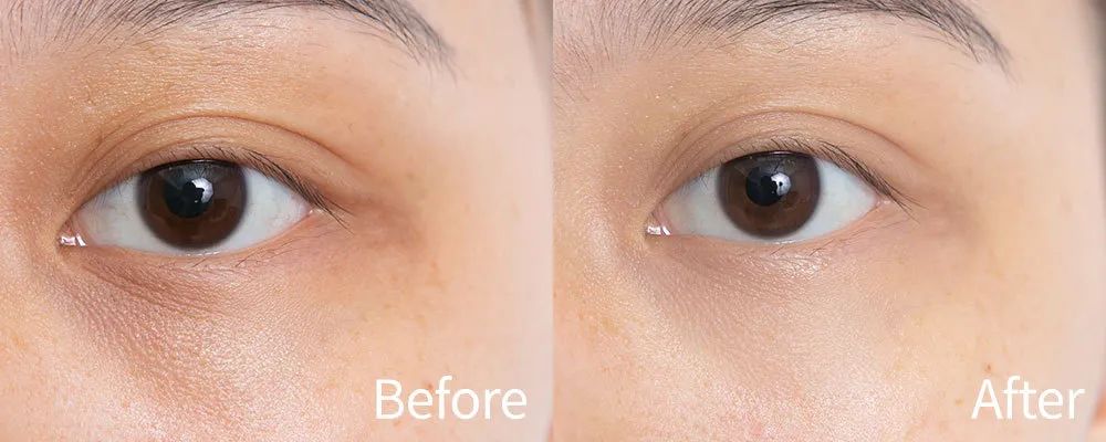 用空瓶回购眼霜,值得空瓶回购的眼霜