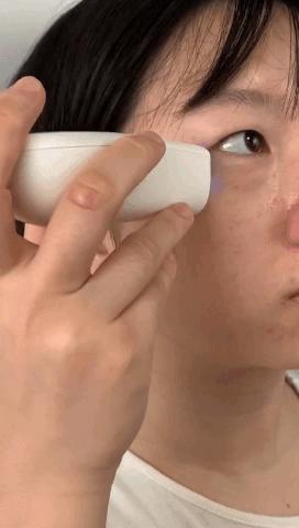 去斑点最有效方法医美去除斑痕,脸上暗沉有斑点可以做什么医美