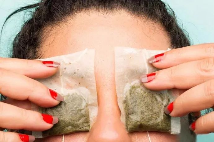 黑眼圈是睡得晚还是缺少睡眠,严重黑眼圈是身体发出的信号吗