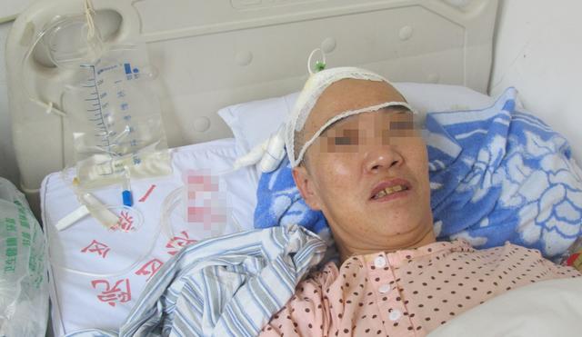 脑积水腹腔分流术后头晕头痛,脑积水分流术后发烧会有什么后果