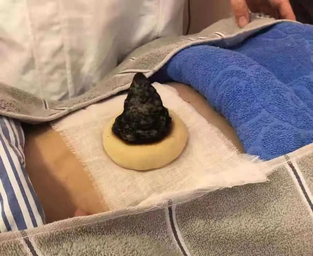 【避孕日】流产可影响女性生育力，科学调理及高效安全避孕方法看这