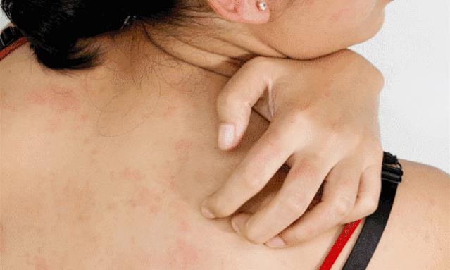 团|墙上插上它，24小时物理除螨，让千万螨虫集体自杀，比太阳暴晒强10000倍