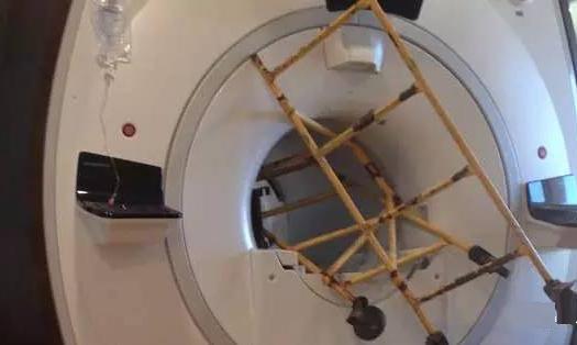 避孕环的事件,避孕环案件