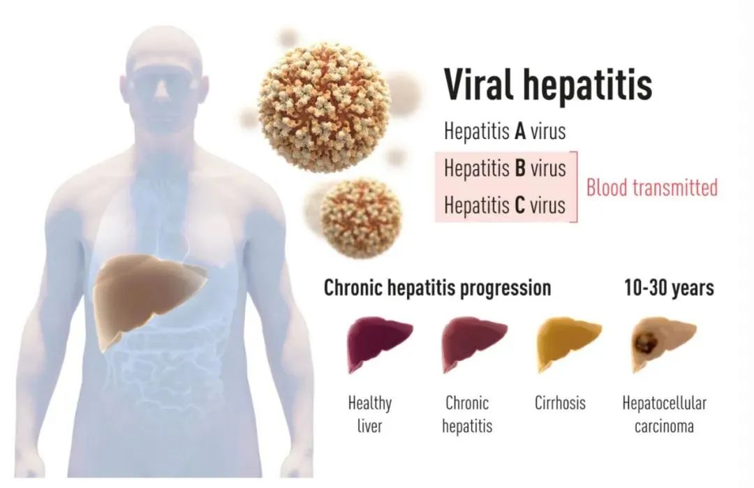 肝炎病毒如何突破人类免疫系统,目前有丙型肝炎疫苗吗