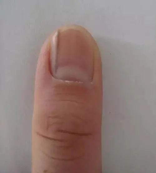 养肝小知识养肝护肝茶要这样喝,养肝护肝茶有科学依据么