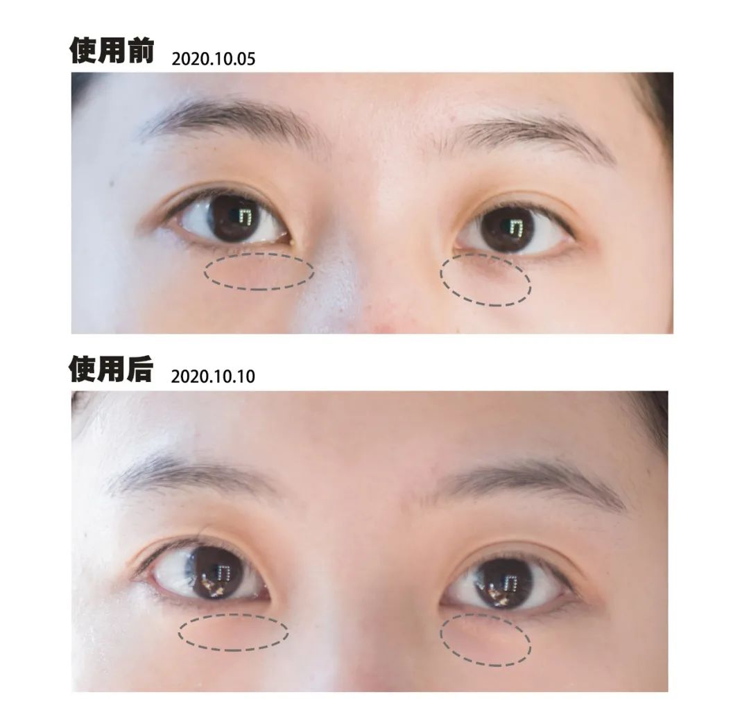 真实有用的几款美容仪,坚持用5年的美容仪