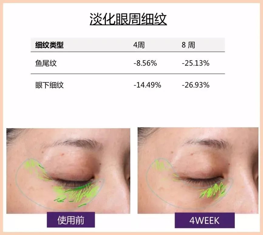 眼霜正品大品牌欧莱雅,眼霜欧莱雅紫熨斗正品