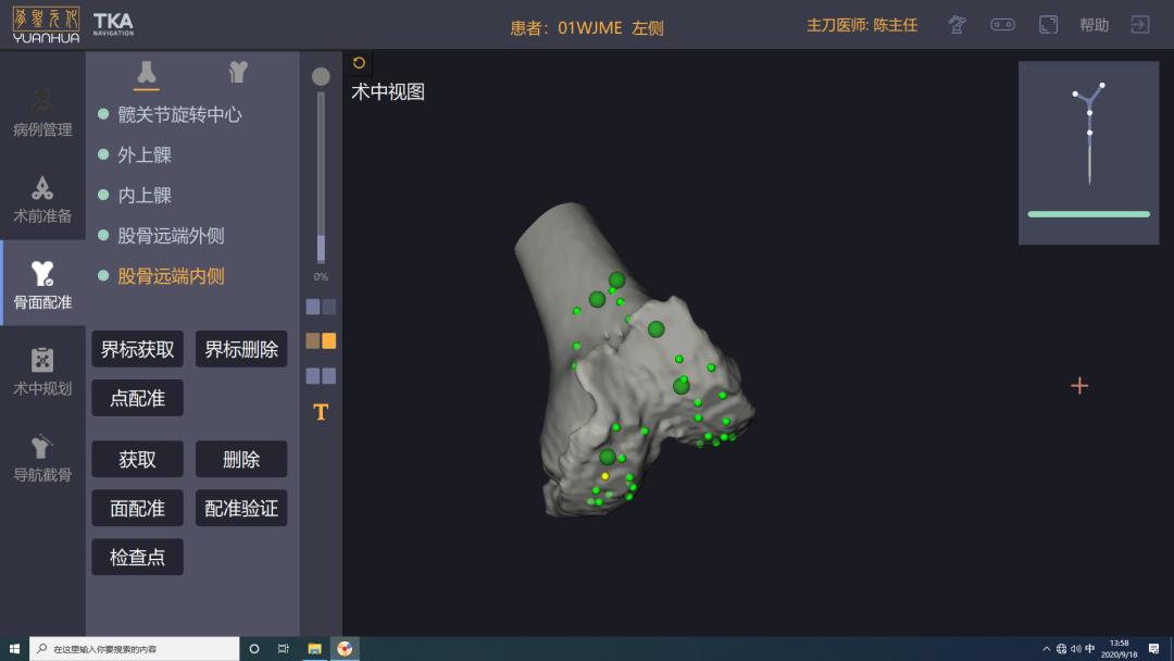 华西膝关节置换,华西医院人工关节置换