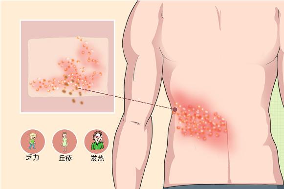 安阳市首批!接种开始