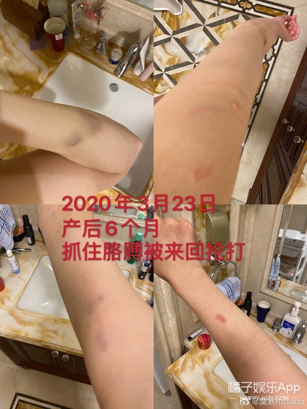 张培萌妻子谈被家暴,张培萌妻子首谈家暴细节全视频