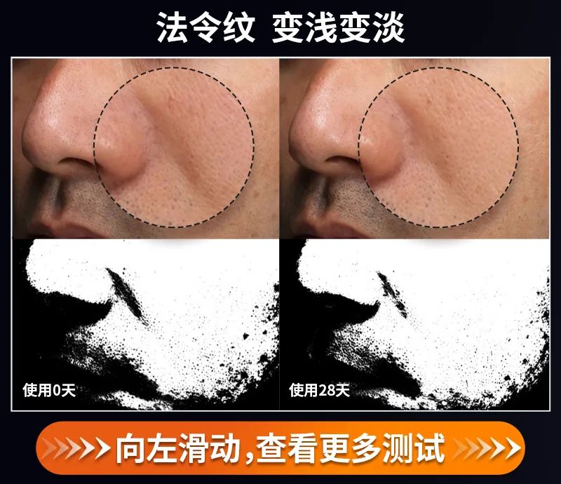 射频美容仪到底怎样,射频美容仪合格吗