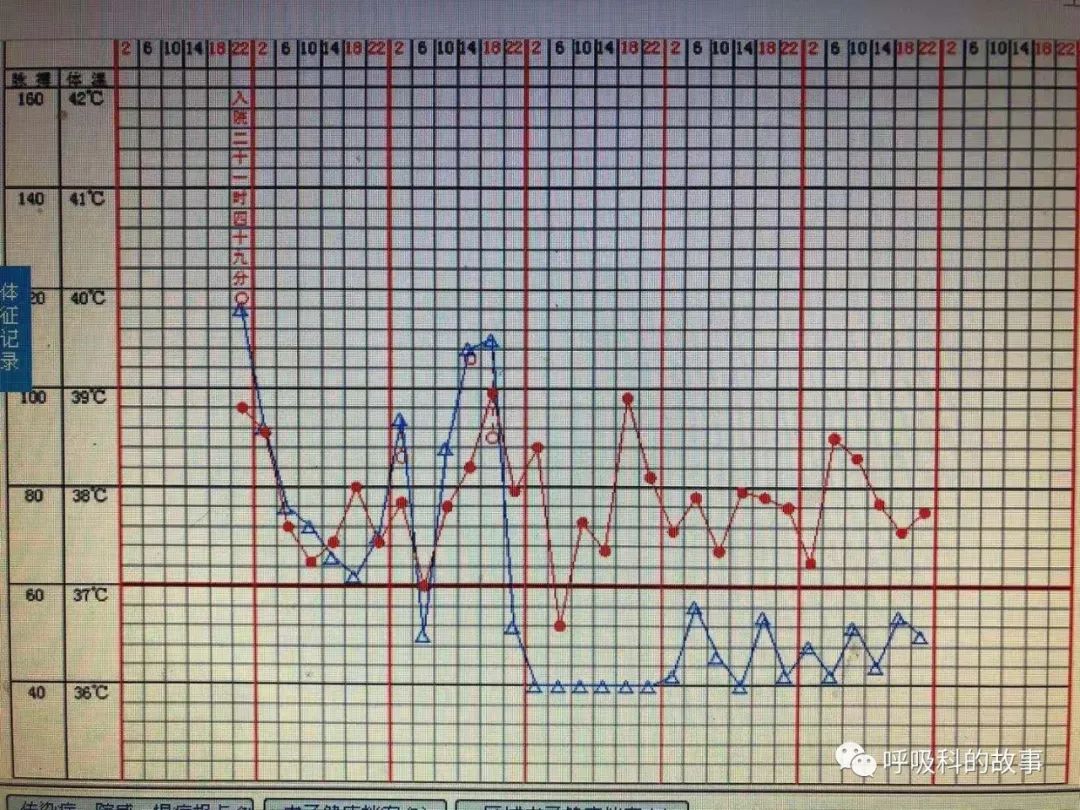 肺炎的最佳治疗方法及药物,肺炎的治疗方法和流程