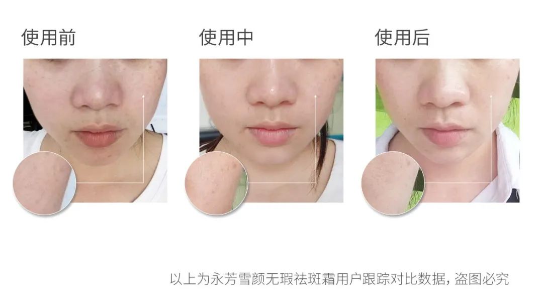 推荐一下你们用过的最好的祛斑霜,公认十大最好的祛斑霜