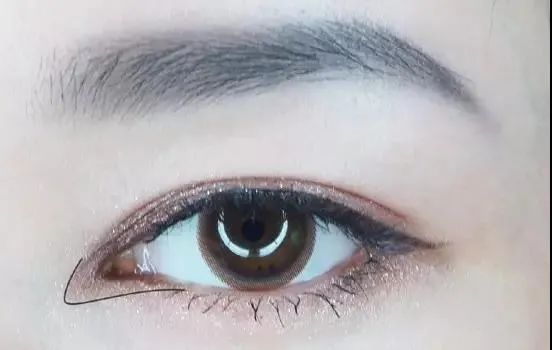 眼综合包含在眼综合吗,眼综合每个人都适合吗