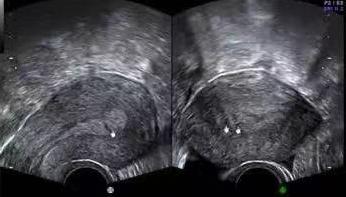 妇幼保健院检查月经,江西省妇幼保健院宫腔镜检查