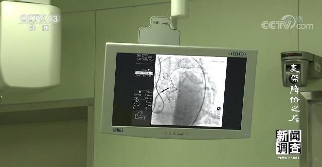 专家说大多数支架没必要做,为何专家说没必要做支架