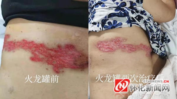 神经内科中医科研项目有哪些,湖医附一小